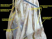 Muscle of the hand . Posterior view.
