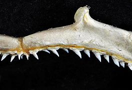 Upper teeth