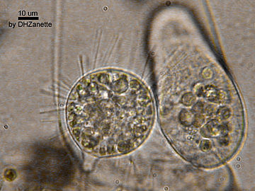 Suctoria sucking another ciliate