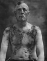 Tarred-and-feathered farmer