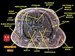 Infraspinatus muscle