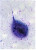 Trichomonas May-Grünwald-Giemsa staining