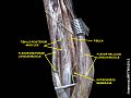 Muscles of the back of the leg. Deep layer.