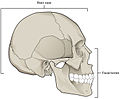 脑颅（标为“Brain case”）与颜面骨（英语：Facial skeleton）。