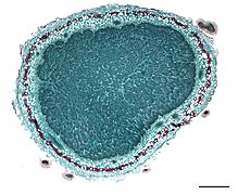 Cross section of the nodule.