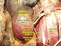 Renal vein