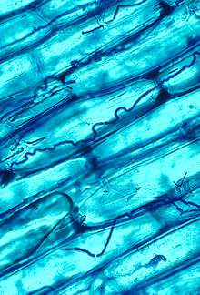 Blue-stained large plant cells with smaller hyphae visible between them