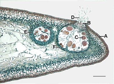 Fucus receptacle with sterile paraphysesz, oogonium, and an ostiole where the opening in the surface of the receptacle is