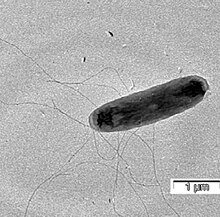 Castellaniella ginsengisoli bacterium, as seen under an electron microscope. It is rodlike in shape and has multiple flagella