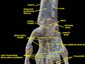 Wrist joint. Deep dissection. Anterior, palmar view