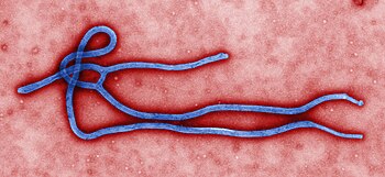 False-coloured transmission electron micrograph of Ebola virus