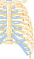 Illustration showing rib fracture at 3rd, 4th and 5th rib