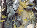 Mesenteric relation of intestines. Deep dissection. Anterior view.