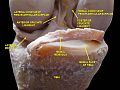 Knee joint. Deep dissection. Anterior view