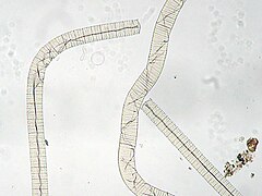 Oscillatoria princeps, a filamentous cyanobacterium found in ponds