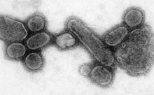 Transmission electron micrograph of influenza A viruses