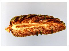 Cross section of maturing shortleaf pine cone showing seeds (arrows).