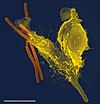 Electron microscope image of a single neutrophil (yellow), engulfing anthrax bacteria (orange).