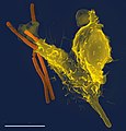 A scanning electron microscope image of a single neutrophil (yellow), engulfing anthrax bacteria (orange)