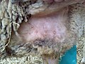 Crusty lesions in axilla