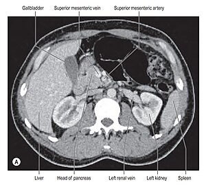 Hilum of the kidney ct scan