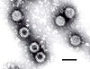 Electron micrograph of Rotaviruses