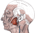 The left masseter muscle (red highlight), shown partially covered by superficial muscles such as the platysma muscle, the zygomaticus major muscle and the zygomaticus minor muscle