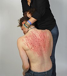 A submissive man is consoled by his dominant after she has made his back bloody by beating.