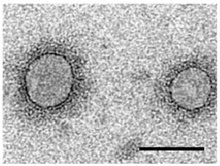 Symptoms of "Fig mosaic emaravirus" on fig leaves