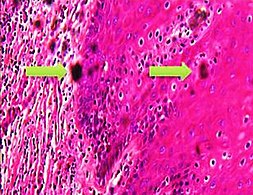 Formalin pigment artifacts