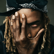 A close up image of Fetty Wap's face who is seen covering his right eye while revealing an ocular prosthesis on his left eye.