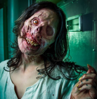 Disfigured woman in mental hospital